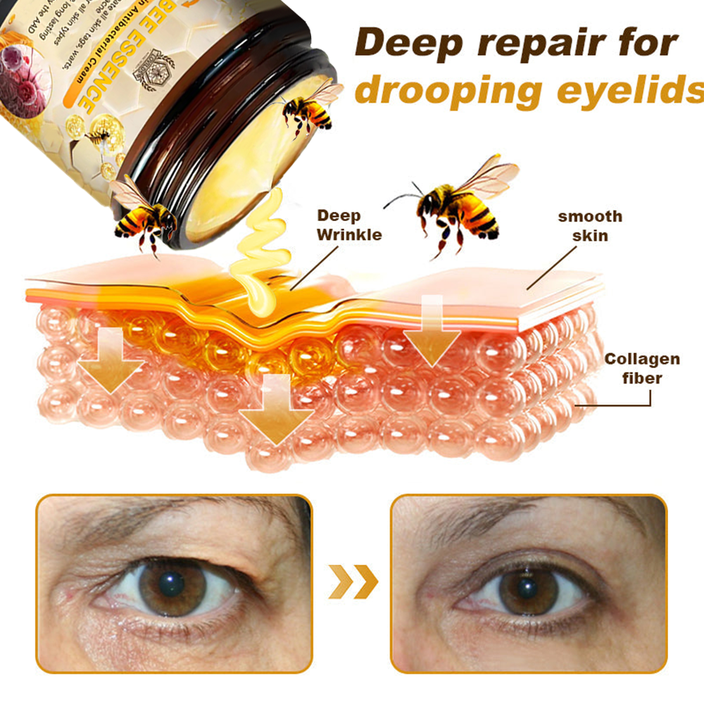 š„LOVILDS⢠Bee Essence Skin Antibacterial Creamāused to treat a variety of skin diseases (AAD recommended).