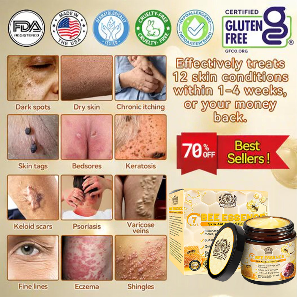 š„LOVILDS⢠Bee Essence Skin Antibacterial Creamāused to treat a variety of skin diseases (AAD recommended).