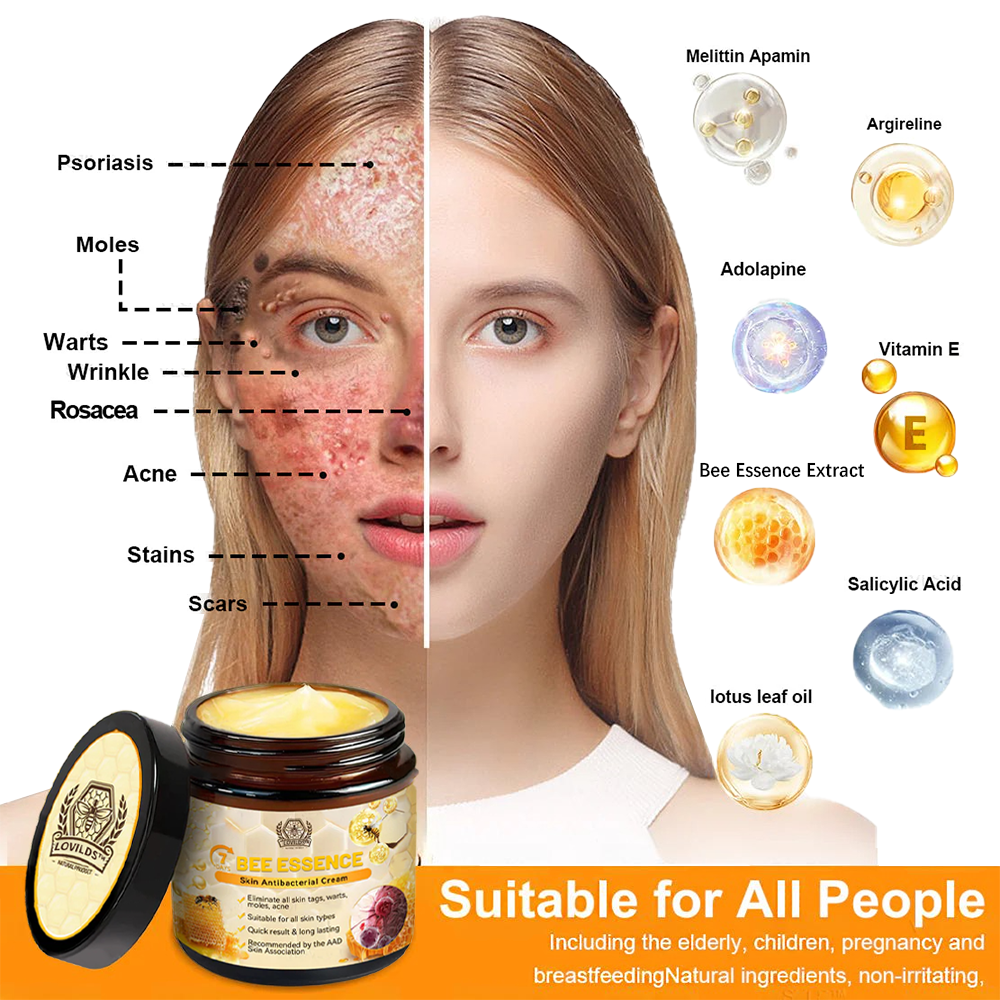 š„LOVILDS⢠Bee Essence Skin Antibacterial Creamāused to treat a variety of skin diseases (AAD recommended).
