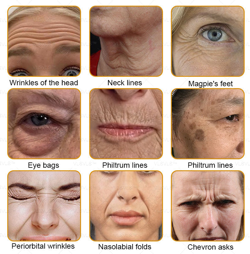 š„LOVILDS⢠Bee Essence Skin Antibacterial Creamāused to treat a variety of skin diseases (AAD recommended).