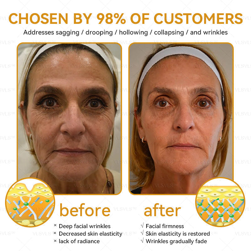 š„LOVILDS⢠Bee Essence Skin Antibacterial Creamāused to treat a variety of skin diseases (AAD recommended).