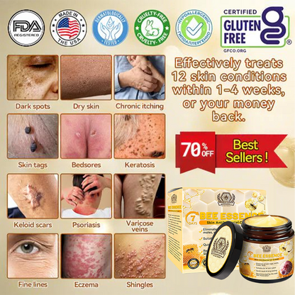 🔥LOVILDS™ Bee Essence Skin Antibacterial Cream—used to treat a variety of skin diseases (AAD recommended).