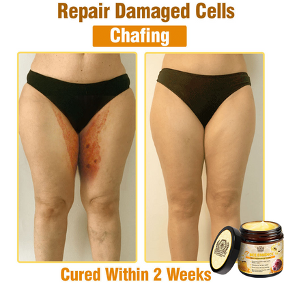 🔥LOVILDS™ Bee Essence Skin Antibacterial Cream—used to treat a variety of skin diseases (AAD recommended).