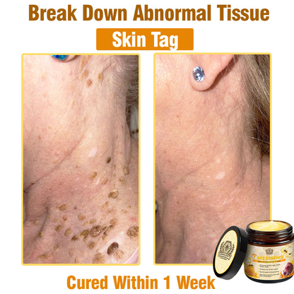 🔥LOVILDS™ Bee Essence Skin Antibacterial Cream—used to treat a variety of skin diseases (AAD recommended).