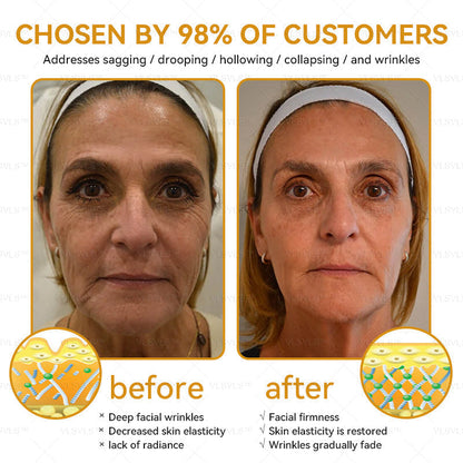 🔥LOVILDS™ Bee Essence Skin Antibacterial Cream—used to treat a variety of skin diseases (AAD recommended).